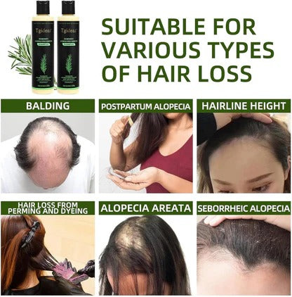 Organic Rosemary Hair Growth Shampoo